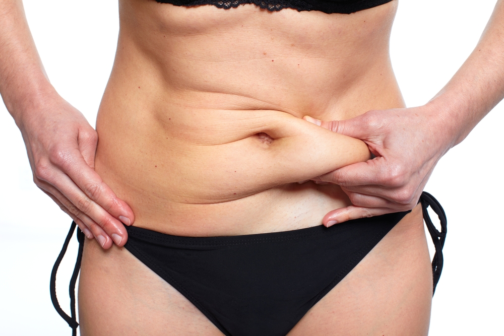 Abdominoplastia ou Lipoaspiração Qual Procedimento é Mais Indicado