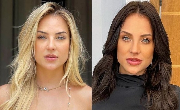 Famosos Que Já Fizeram Harmonização Facial