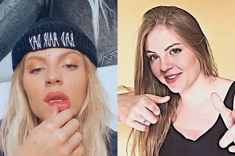 Luísa Sonza revela se já fez algum procedimento estético